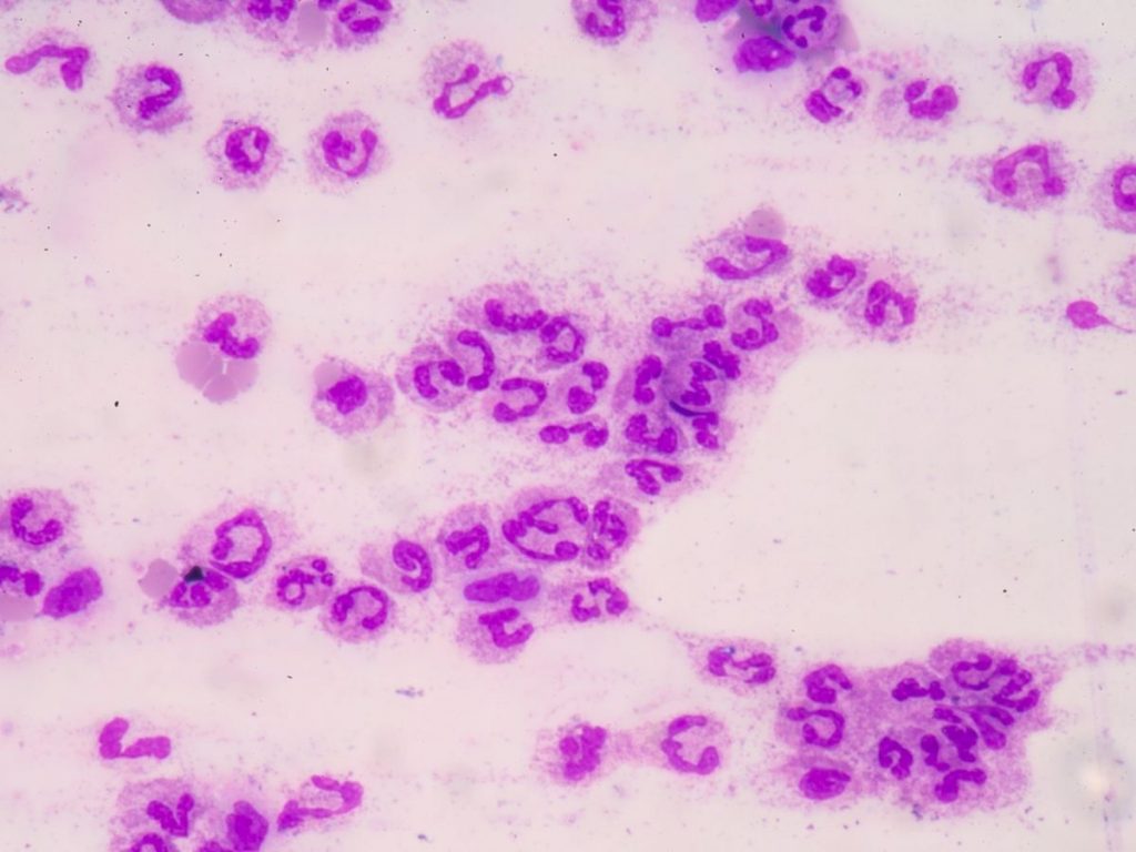 Pneumococcus Causative Organism Varieties and Prevention Methods