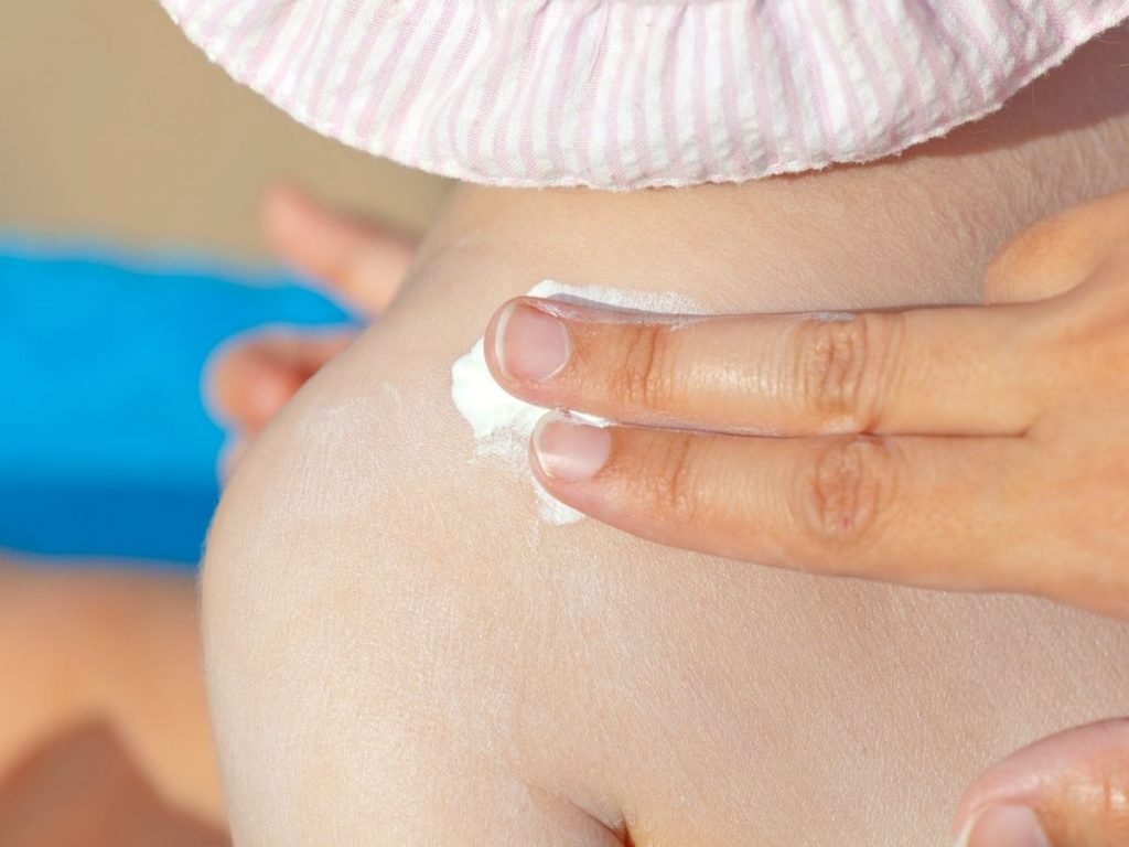 Best Ways to Prevent Babys Dry Skin Problems