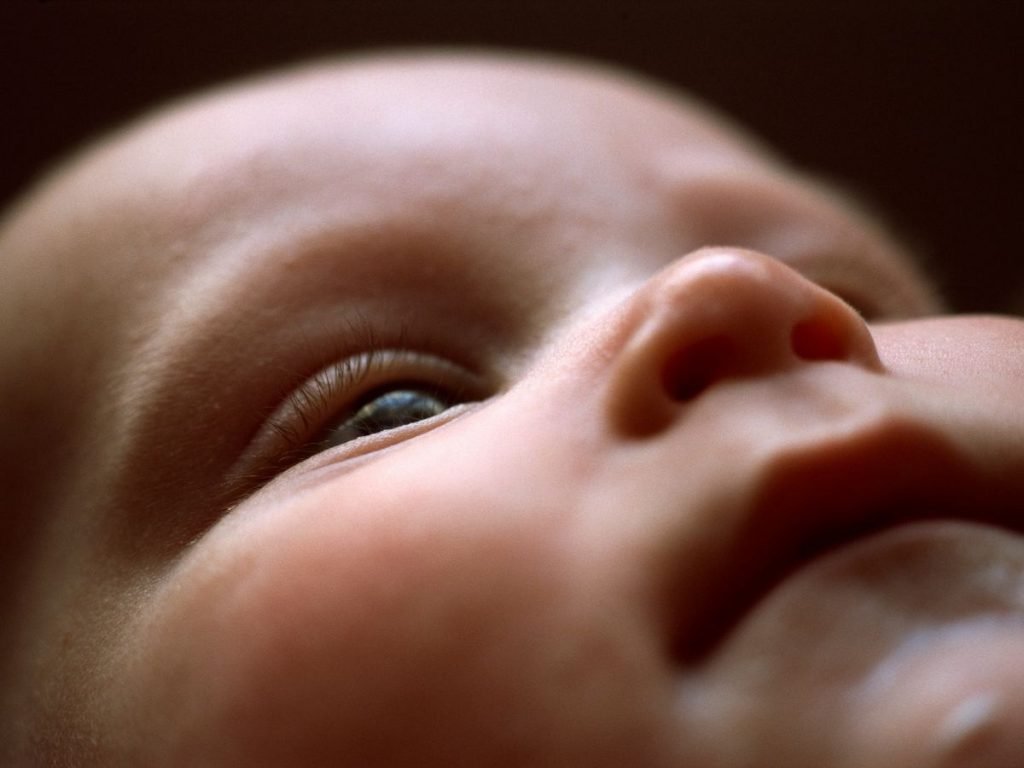 What to Do If Babys Face Turns Yellow