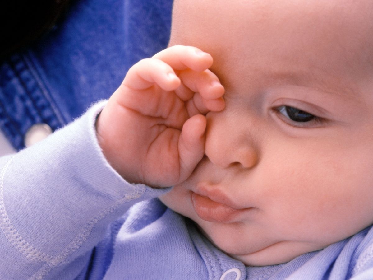 Why Do Some Babies Have Excess Eye Gunk