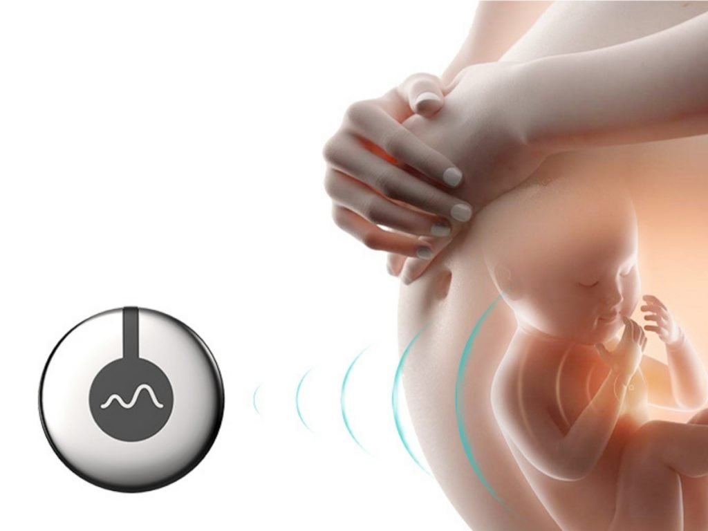 Top 10 Best Baby Prenatal Monitors