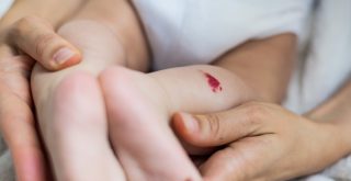 Red Birthmark on Newborn Babies Causes and Treatments